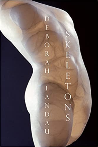 Book Cover Image of “Skeletons”